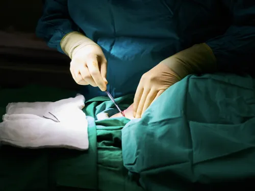 Un kilo de vis et clous retrouvé dans l’estomac d’un patient